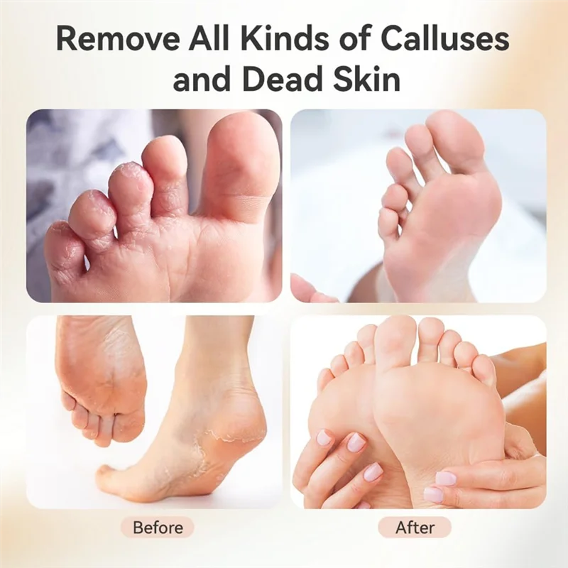 Callus Remover For Feet, 2 In 1 Electric Foot Callus Remover, Replacement Sandpaper Foot File Grinder Toolb64b