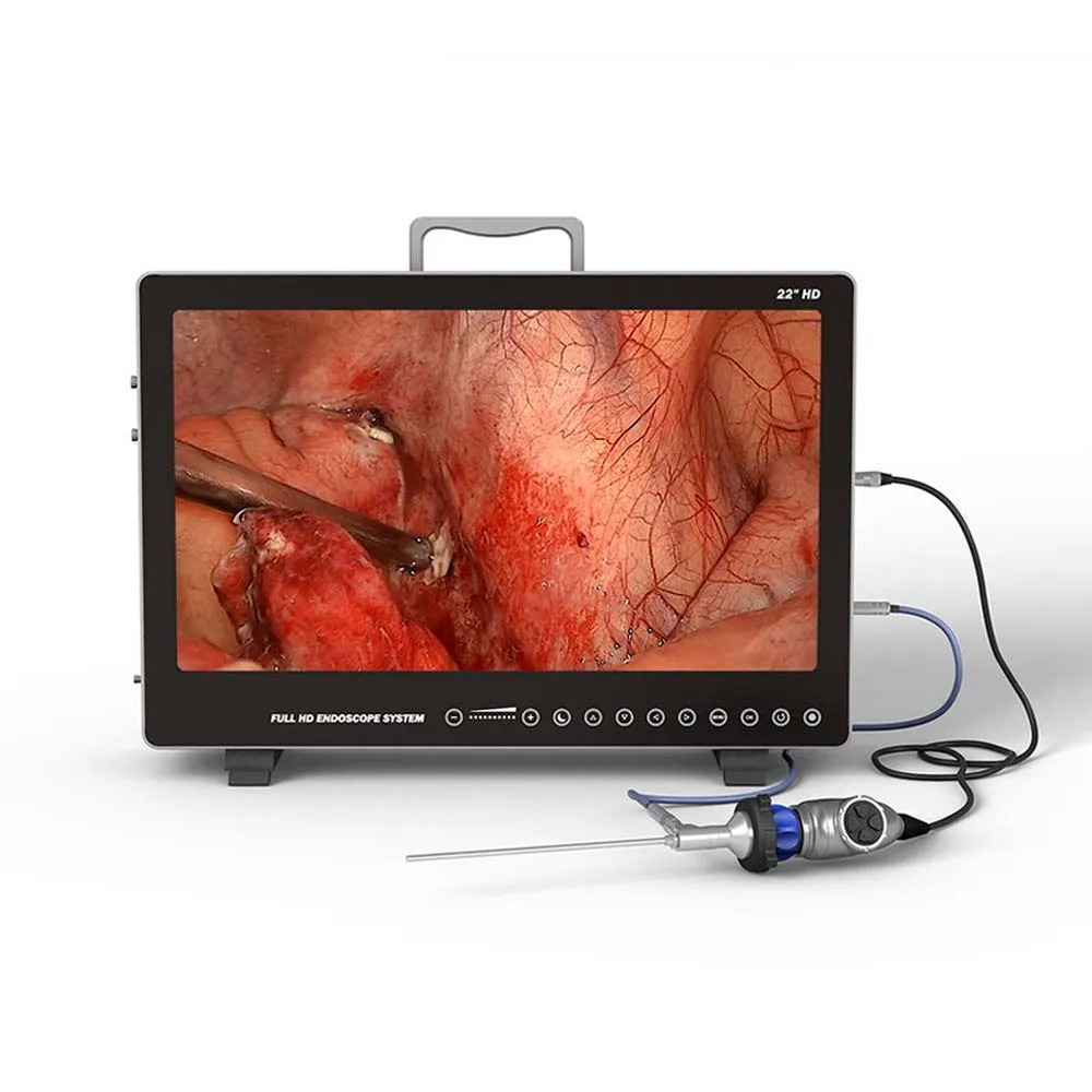 

Portable Endoscopy System Medical Imaging Equipment HD Endoscope for ENT Laparoscopy Hysteroscopy Urology