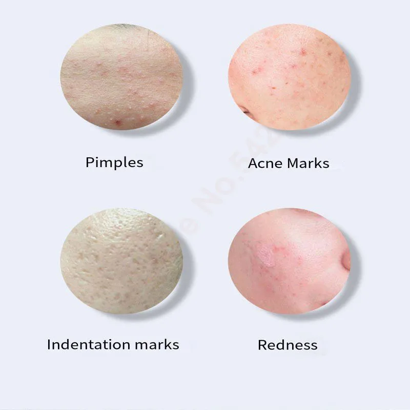 Oligopeptide Repairing Face Serum Facial Anti-Wrinkle Anti-Aging Firming Whitening Acne Treatment Lift Korean Skin Care Products 6