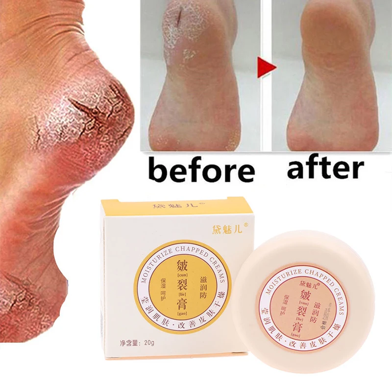 

20g Oil Anti-Drying Crack Foot Cream Heel Cracked Repair Cream Removal Dead Skin Hand Feet Care Foot Mask