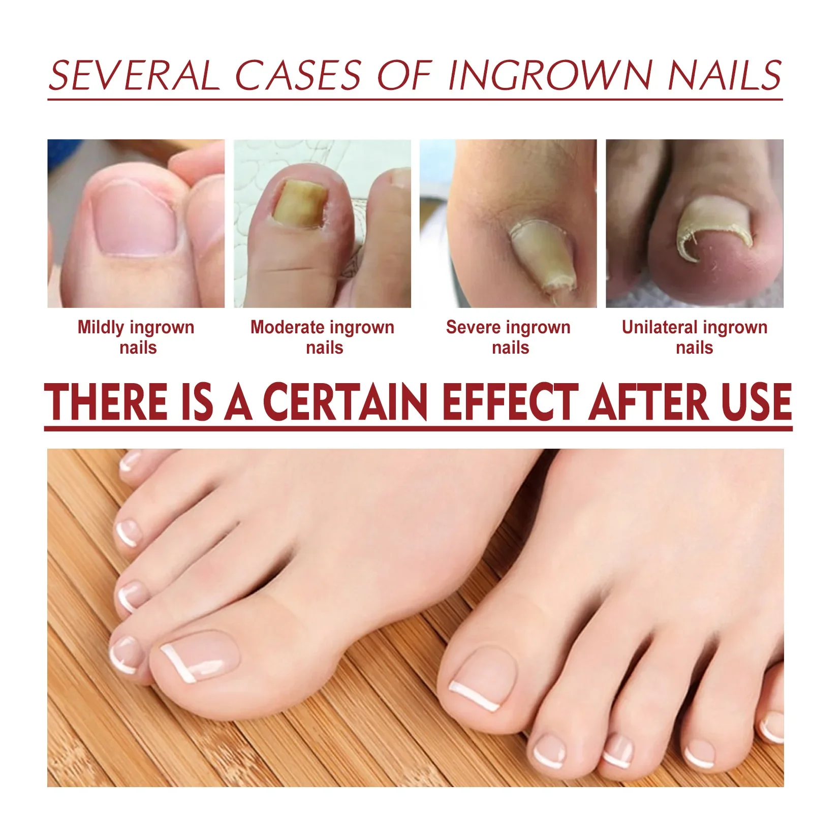 10ml Paronychial Sulcus Nursing Oil Repair Ingrown Armor Grey Nails Paronychial Sulcus Relieve Soft Armor Bright 발톱무좀