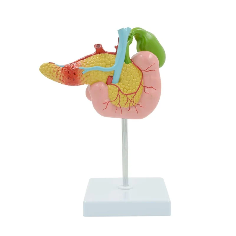 

Medical Anatomical Human Pancreas Duodenum Gallbladder Model Pancreas Organ Anatomy Science Learning Aid