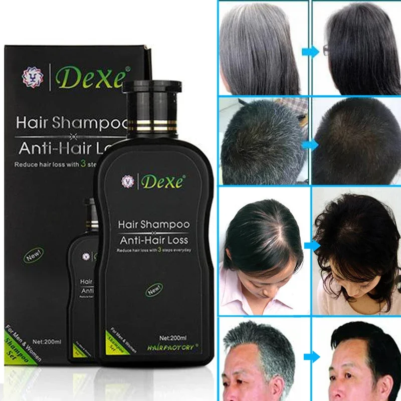 Dexe Hair Growth Shampoo Set Anti-hair Loss Chinese Herbal Growth Product Prevent Hair Treatment hair care free shipping