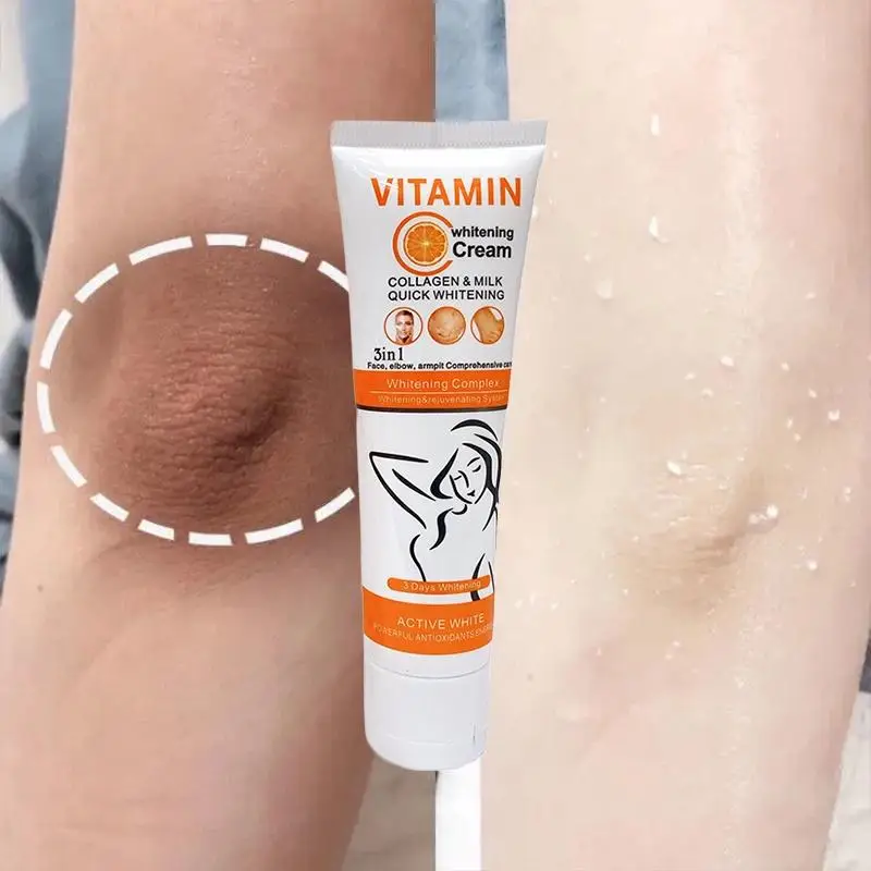 Whitening Cream Private Parts Armpits Knees Arms Thighs Skin Whitening Remove Melanin