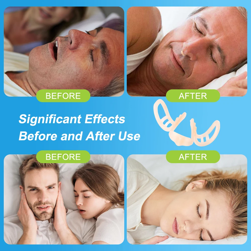 Anti Snoring Device Nasal Dilator Silicone Nose Clip Improve Sleep Sleeping Aid Device Anti-Snoring Improve Sleep Snoring