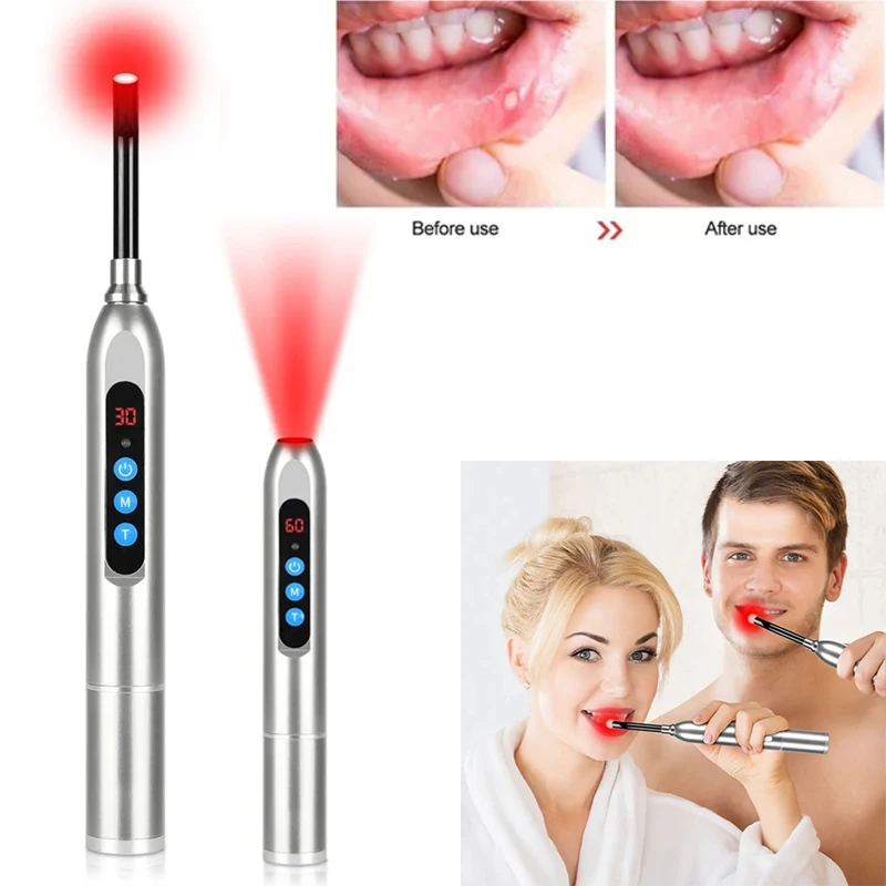 Cold Sore Laser Light Therapy Device Canker Sore Treatment Infrared Wand for Mouth Nose Ear Knee Feet Hands Ankle Skin Care