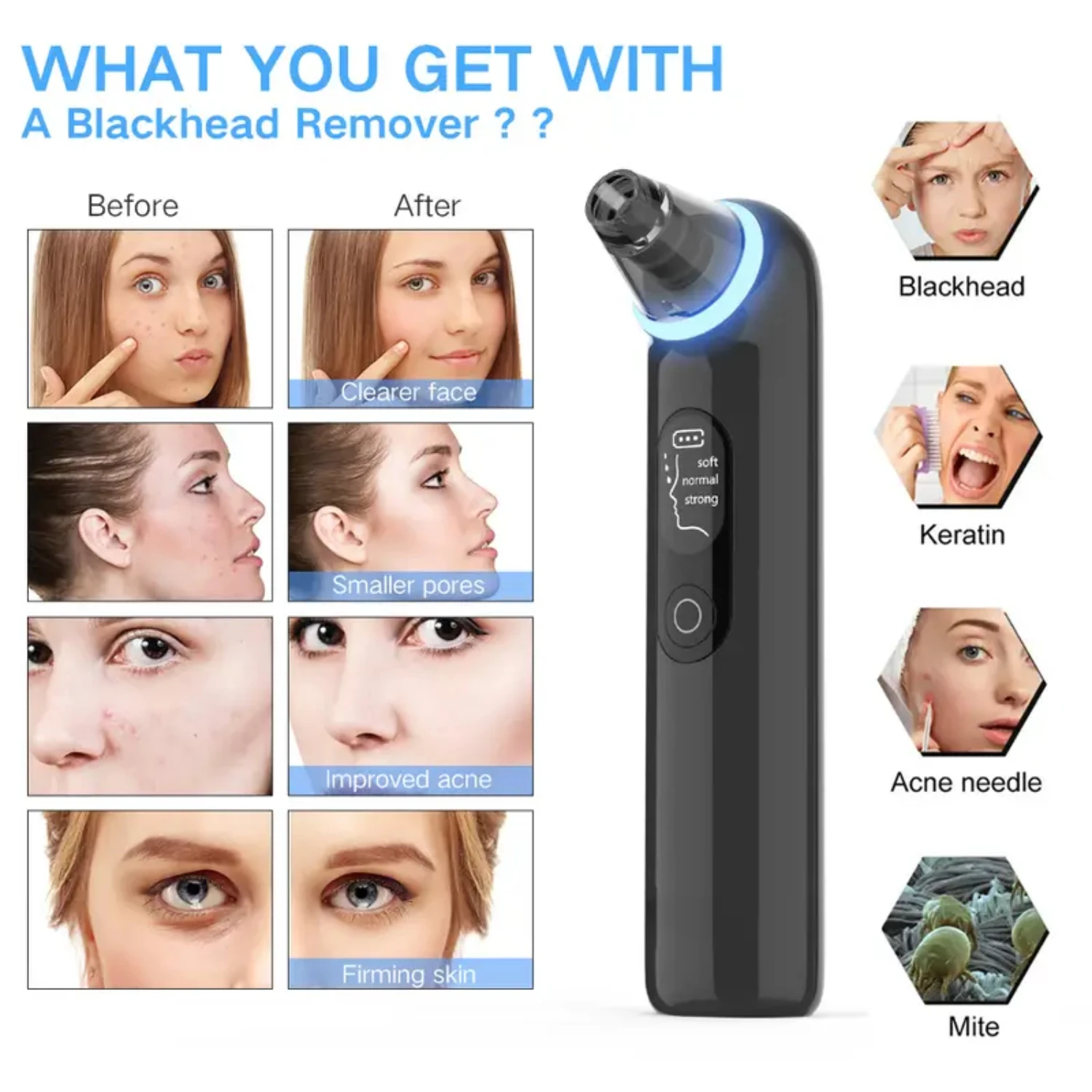 USB Rechargeable Blackhead Remover Pore Vacuum Cleaner with Strong Suction for Deep Cleaning and Pore Minimizing-Effective Bla