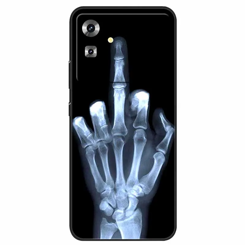 Cool Wolf Lion Design Soft TPU Silicone Phone Case – Protective Cover