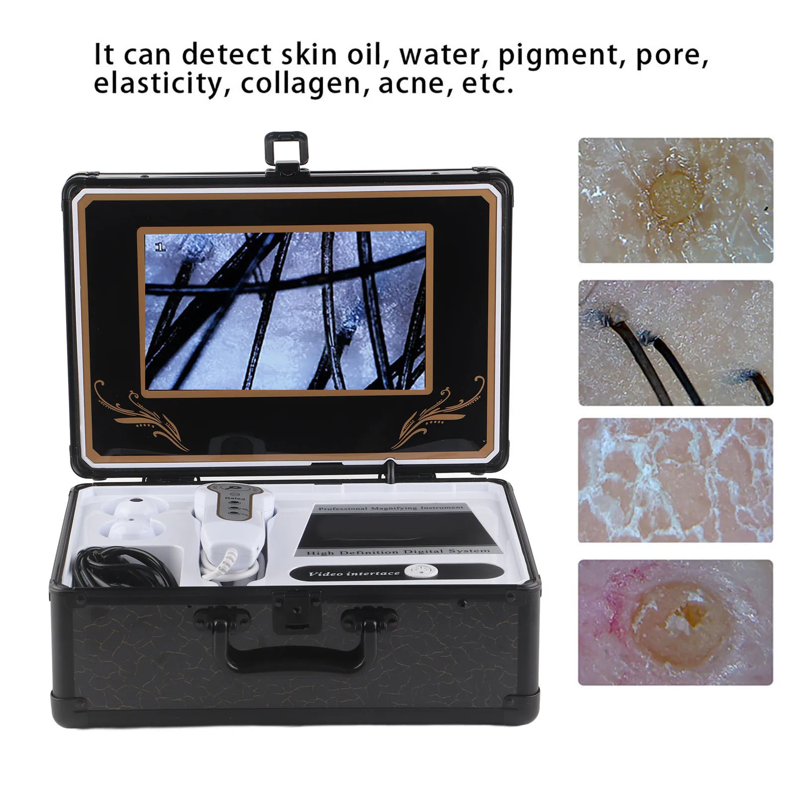 Dermatoscope électronique SODIAL – Caméra D’analyse Du Cuir Chevelu P1150
