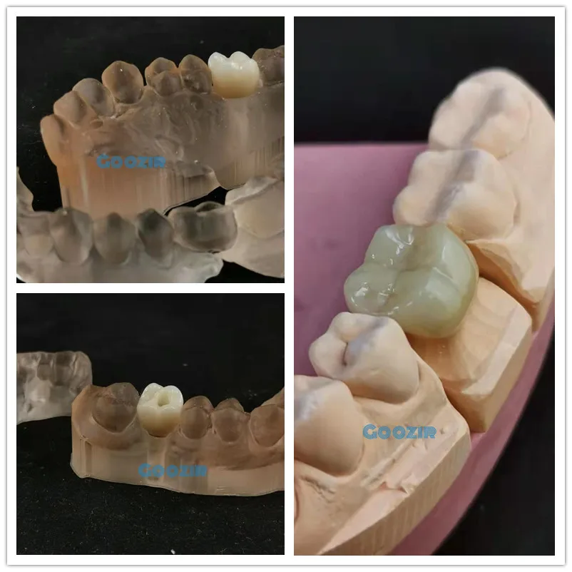 

Zirconia Blocks Zirconia Dental Block for Dental Lab Amman System Milling Machine