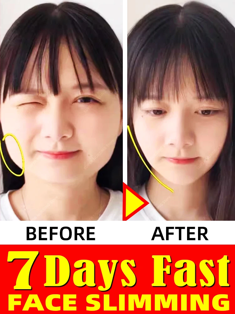 

Remove double chin