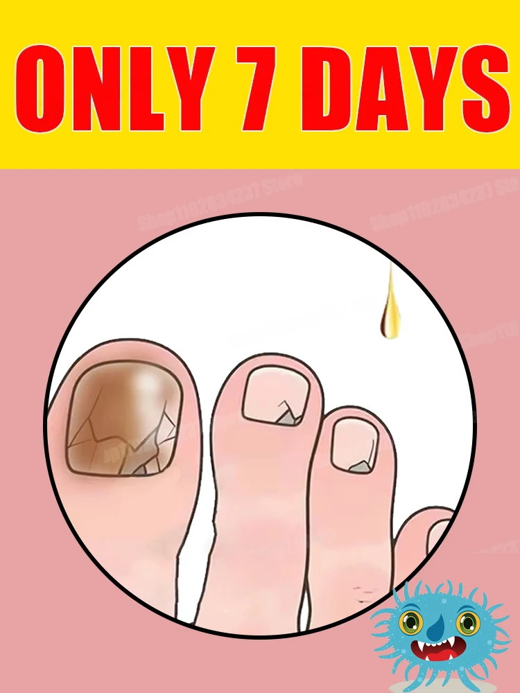 รีจูวีเนเตอร์ -เทคโนโลยีป้องกันเชื้อรา - ระบบควบคุมและเซ็นเซอร์ความปลอดภัยแบบปรับได้ร้อน 1