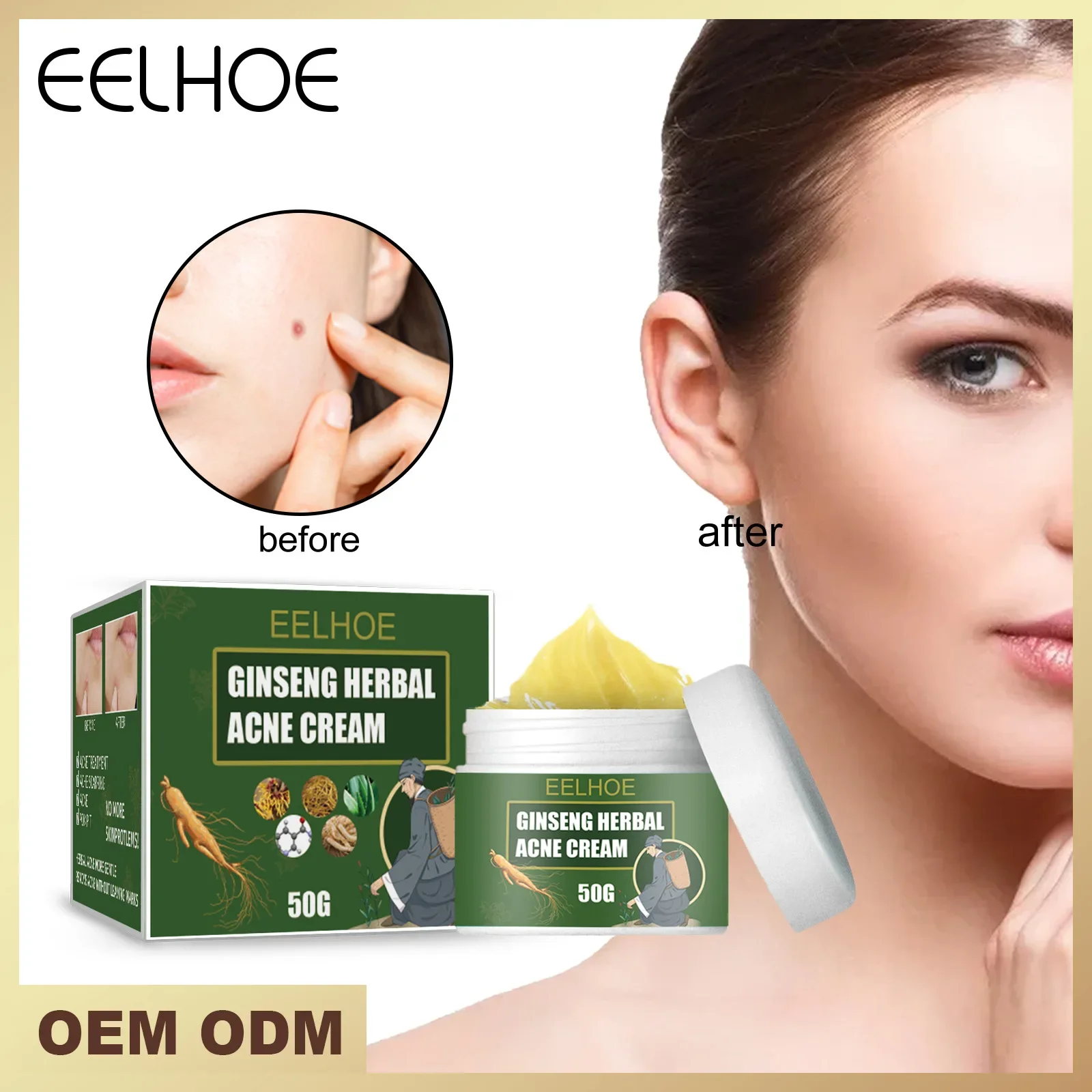 

Acne Removing Cream Lighten Acne Printing Water Oil Balance Acne Removing Cream Moisturizing Removing face cream