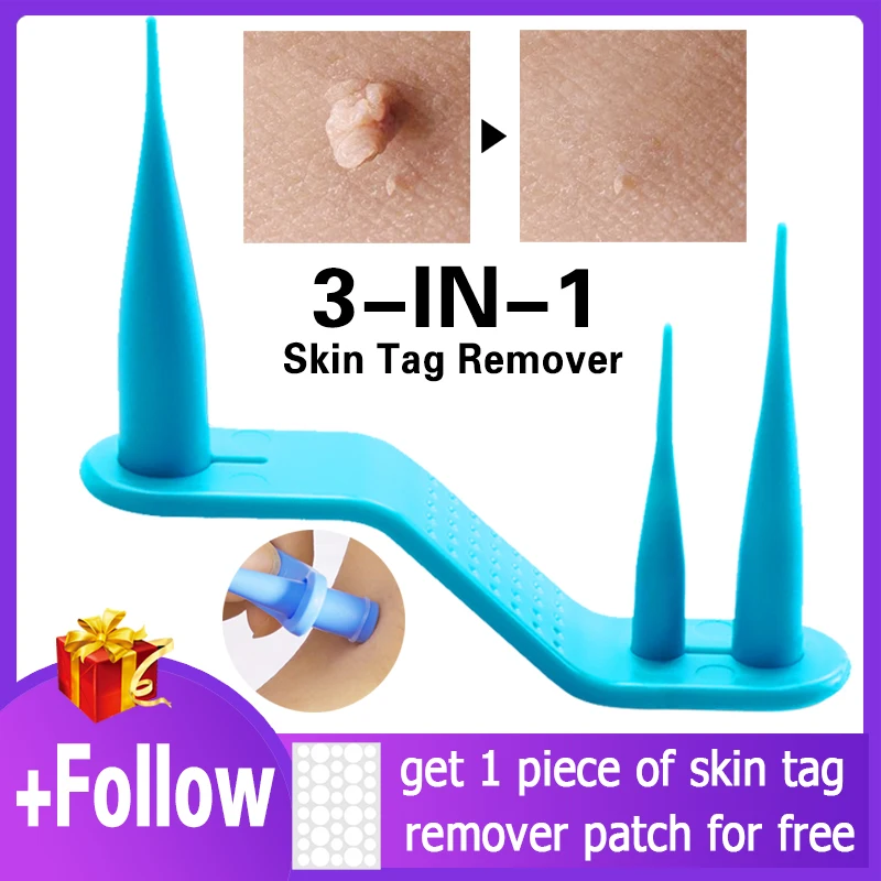 3 In 1 Auto Skin Tag Remover Warts Mole Skin Tag Removal Kit Facial