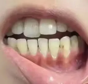 Charcoal Whitening Powder