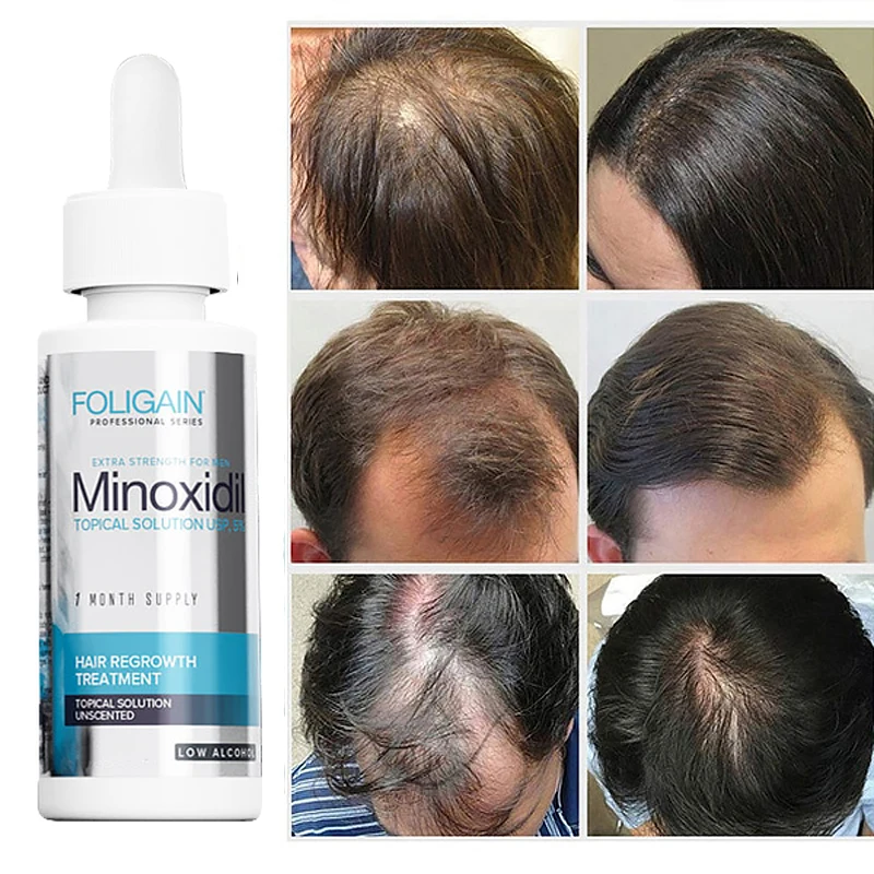 MlN0XlDL Hair Rapid Growth Spray for Men's Body and Chest and Eyebrows and Beard Thick Hair Treatment Loss Product 50ml