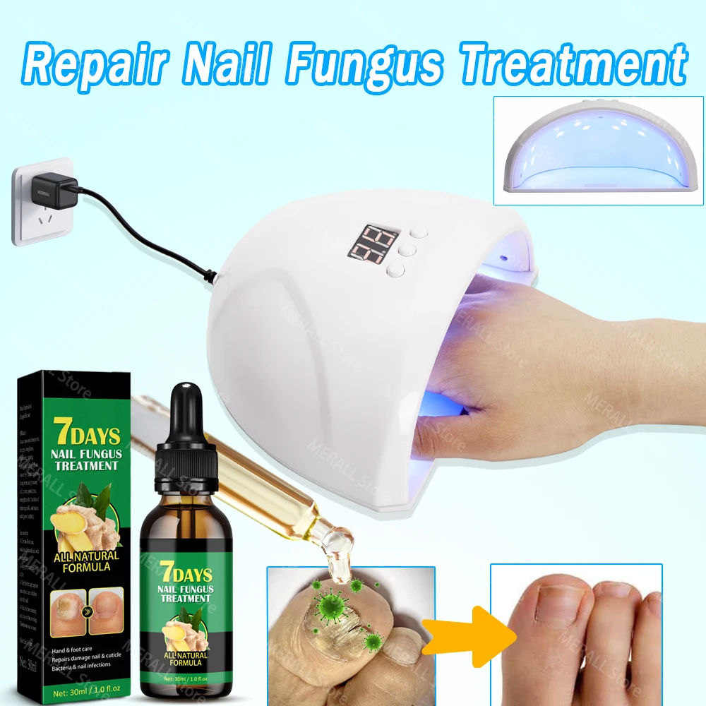 Toenail Nail Fungus Treatment Repair Fingernail Device Toenail Treatment for Foot Nail Fungus Essential Oil Onychomycosis Care