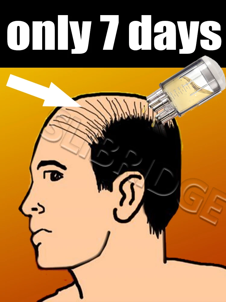 หวีทาเซรั่มบำรุงหนังศีรษะสำหรับการรักษาหนังศีรษะและเส้นผม กระตุ้นรูขุมขนที่หย่อนคล้อยเพื่อผมหนาขึ้น เซรั่มบำรุงผม 1