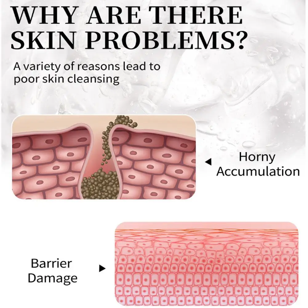 Facial Exfoliant Face Exfoliating Cream Skin Care Whitening Moisturizer Repair Facial Scrub Cleaner Acne Blackhead Treatment Remove Face Cream
