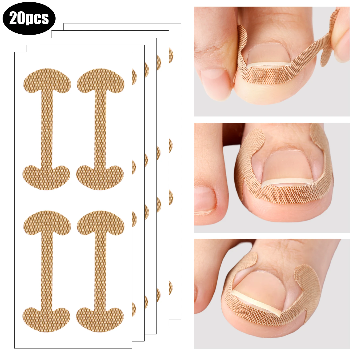Ingrown Toenail Correction Strips Lasting Adhesion Waterproof Nail Correction Stickers Elasticity Toe Care Pedicure Tools 100pcs