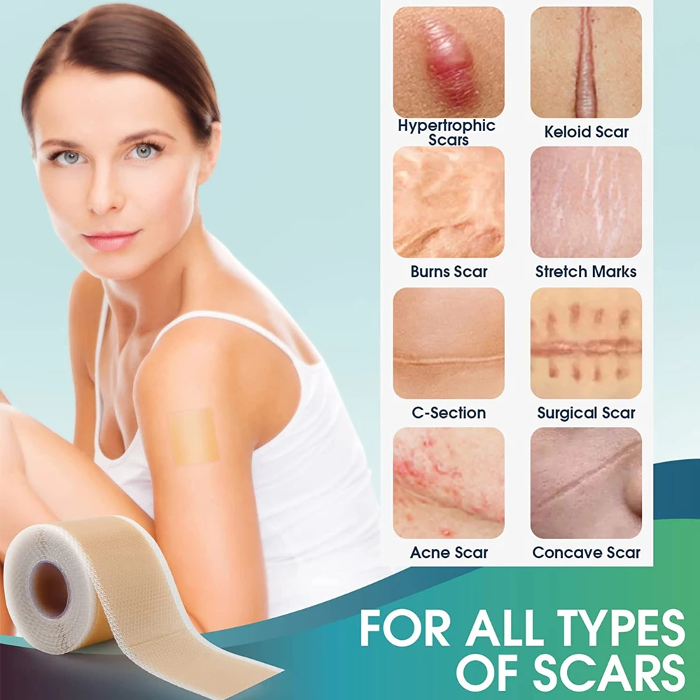 1Roll Silicone Scar Sheets Keloid Bump Removal Strips Scar Reducing Treatments Surgical Scars Burn Tummy Tucks Acne C-Section