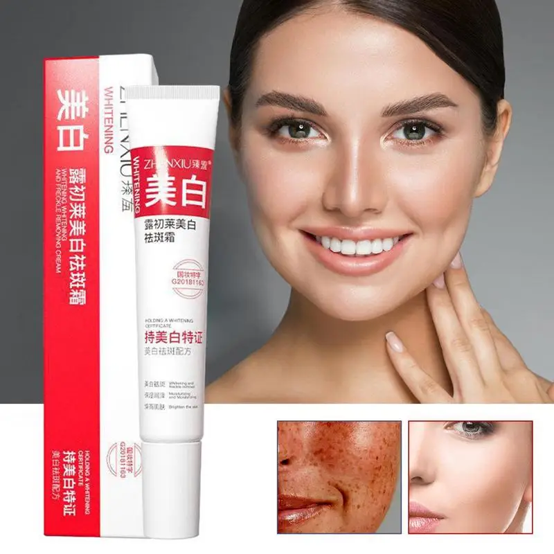 

Whitening Freckle Cream Effective Remove Melasma Serum Fade Dark Spots Melanin Moisturize Brighten Face Skin Care