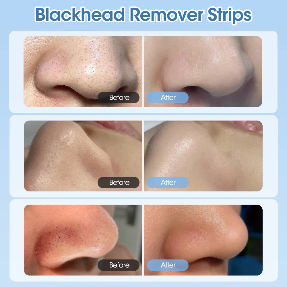 Nose Blackhead Remover Cream and Paper Strip Pore Cleanser