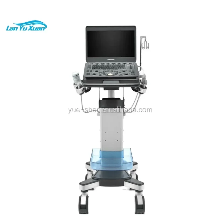 Рисунок 2 - Заводская цена, портативная 3D