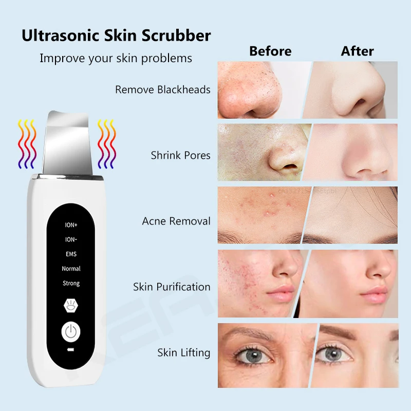 Ultrasonic Skin Scrubber Facial Shovel Deep Cleaning Blackhead Remover Face Pore Cleanser Dead Peeling Cavitation Ion EMS Lift