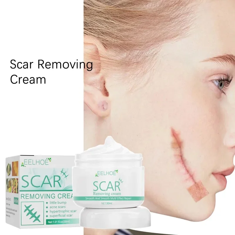 

Burn Scald Scar Removal Gel Remove Acne Spots Treatment Stretch Marks Surgical Scar Repair Cream Smoothing Whitening Skin Beauty