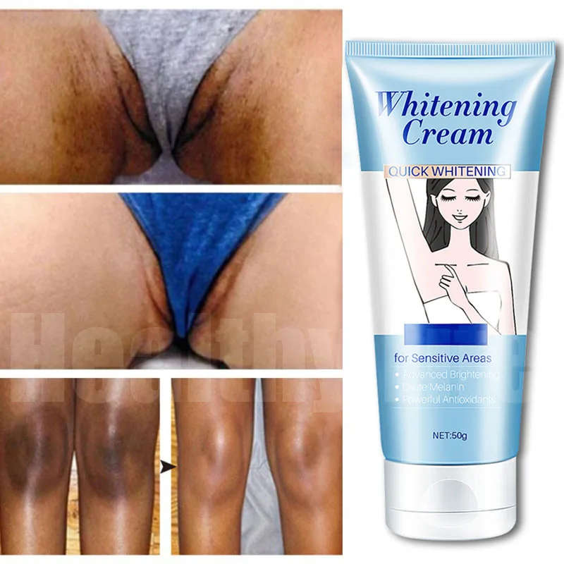 

Body Whitening Cream Effective Improve Dark Spots Armpit Legs Bleaching Cream Dull Melanin Remover Private Parts Brighten Serum