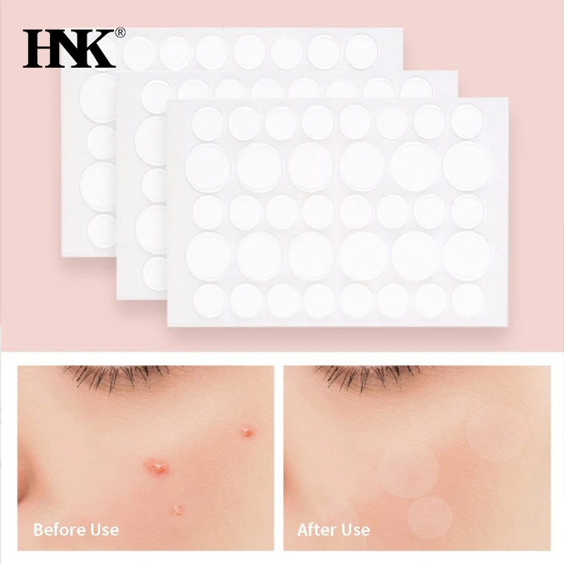 

36Pcs Pimple Remover Patch Stickers Acne Pimple Patch Stickers Invisible Acne Treatment Facial Skin Care Beauty Tool