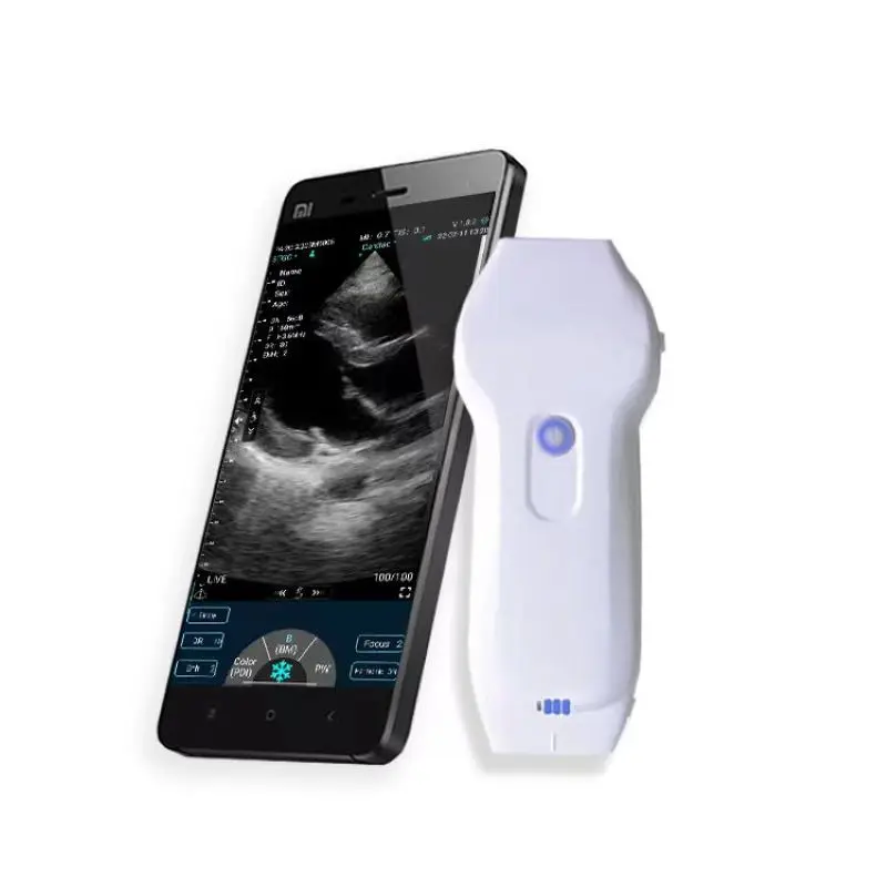 Color Ultrasound Doppler 3 in 1 Probe Convex Linear Phased Array Support iOS Android Windows Complimentary Suitcase