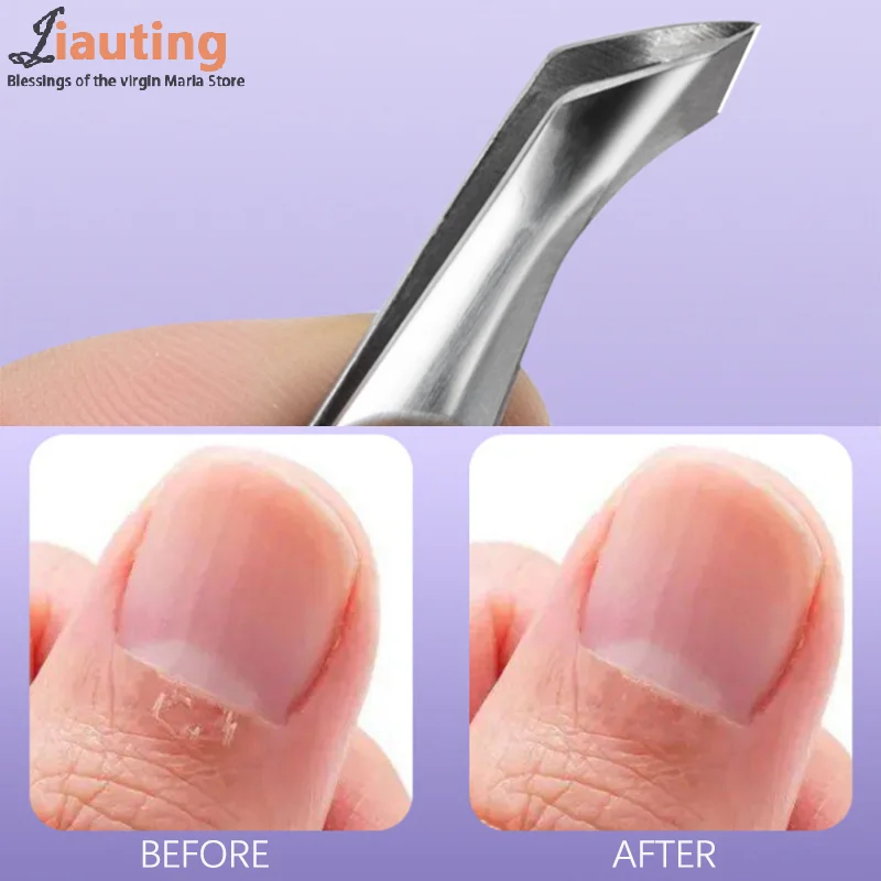 Mini Hangnail Squeeze And Snip Toenail Ingrown Dead Skin Remover Nail Art Cuticle Nipper Clipper Edge Cutter Manicure Plier Tool