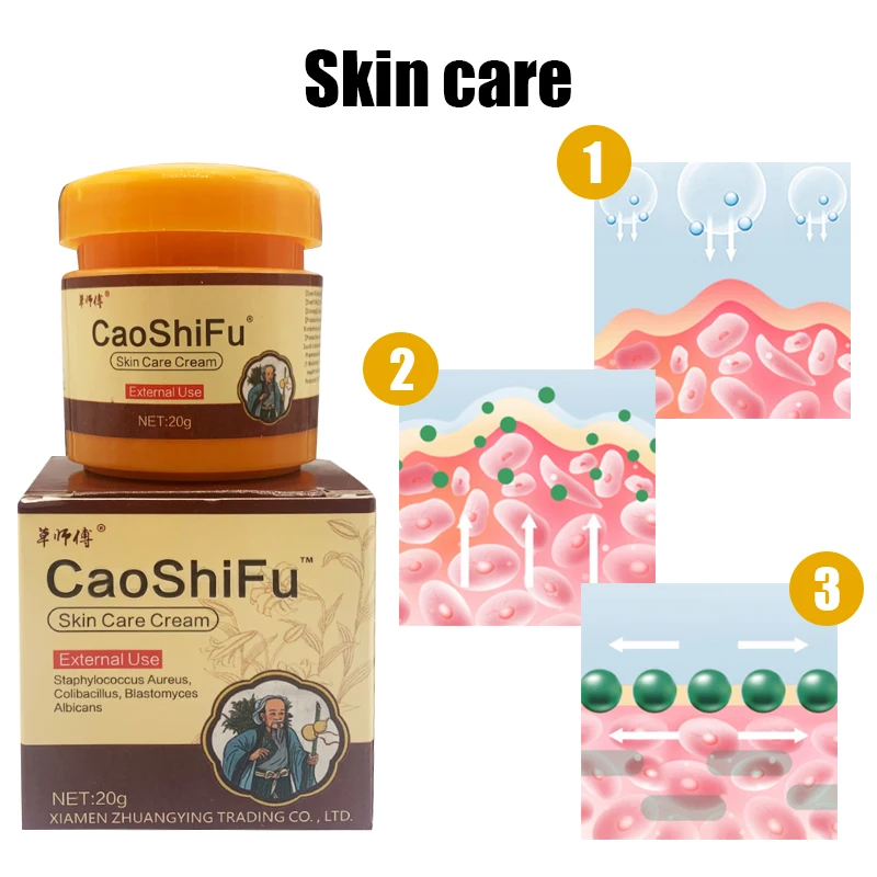 20g Psoriasis Antibacterial Cream Dermatitis Eczematoid Ointment Anti-Itch Chinese Herb Skin Care Cream Psoriasis Ointment