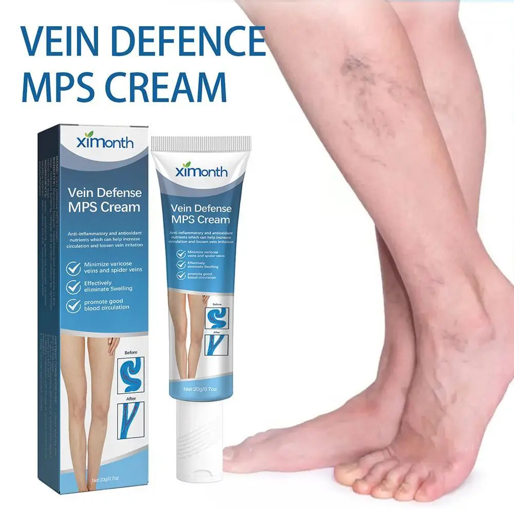 

20g Varicose Vein Cream Foot Care Effective Leg Soreness Swelling Relieve Vasculitis Phlebitis Spider Pain Treatment Tools