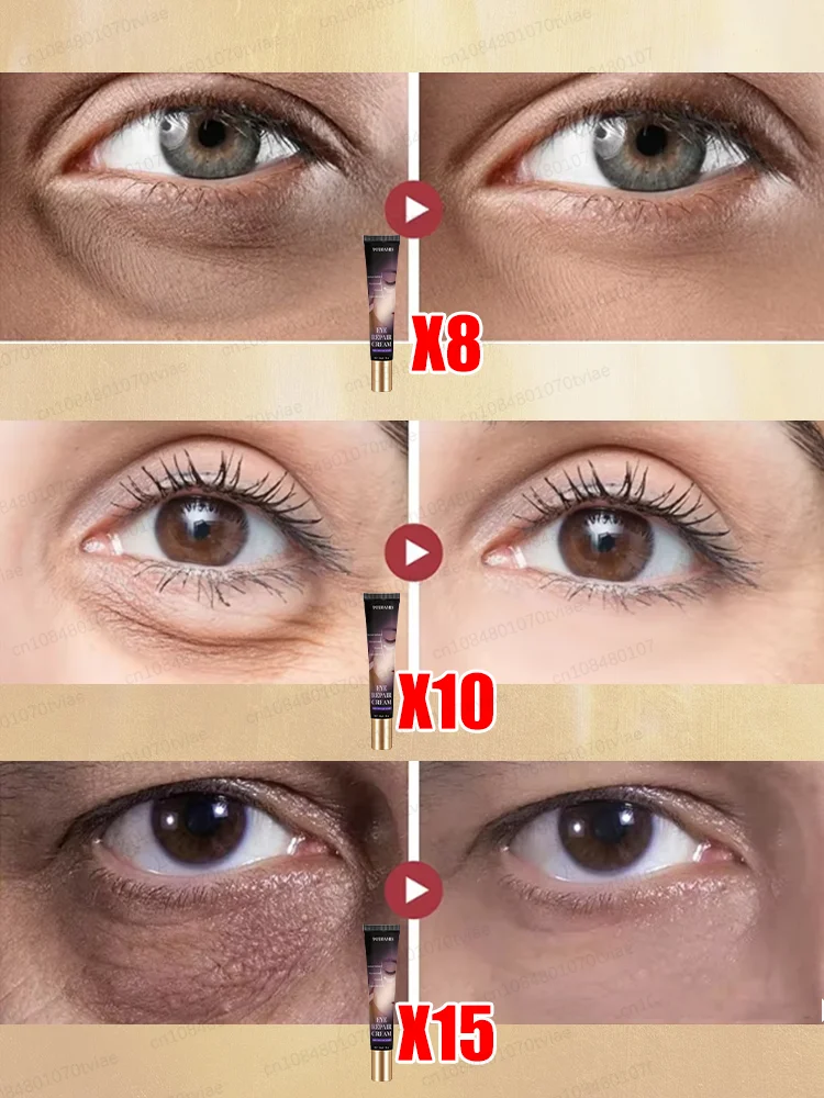 Effective eye cream eliminates wrinkles eye bags dark circles tightens skin brightens skin in 7 days beauty enhancement product