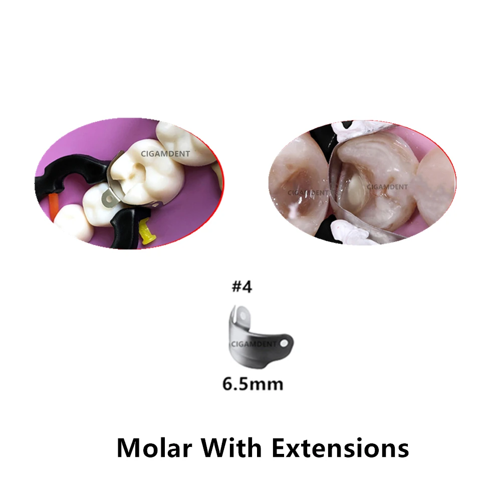 Las Mejores Ofertas En Sistemas De Matriz Dental Endodoncia Sin Marca Y Cuñas | EBay