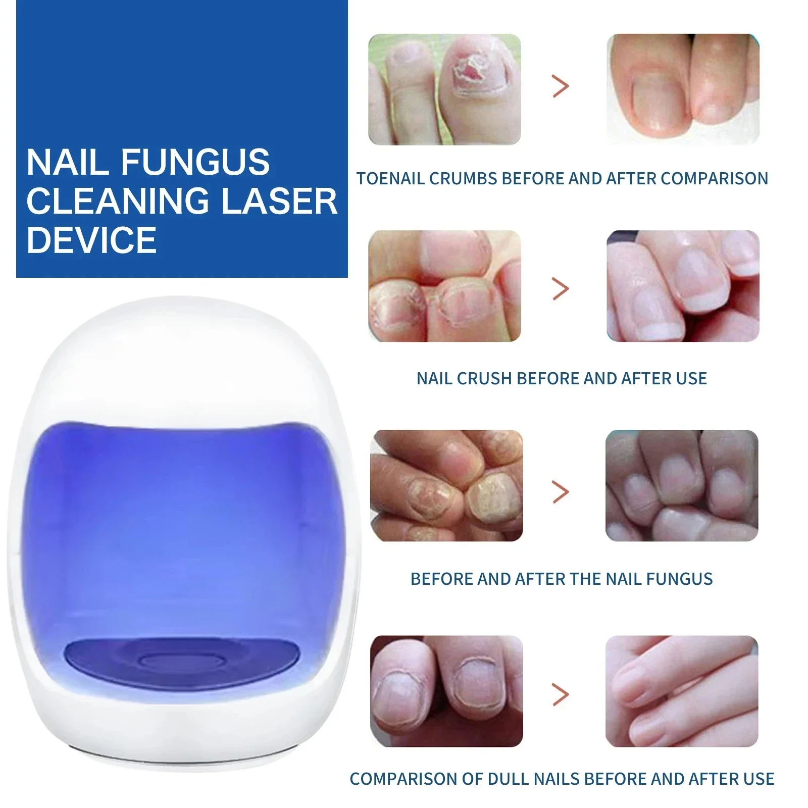 Nail Fungus Treatment Device Foot Toe Nails Fungal Repair Serum Anti Infection Gray Nails Onychomycosis Paronychia Remove Tools 2