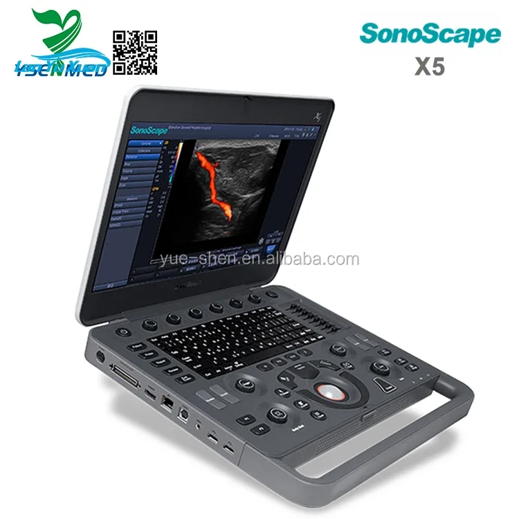 Рисунок 5 - Заводская цена, портативная 3D