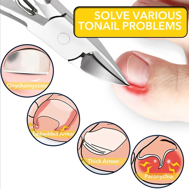 Stainless Steel Toenail Nail Clippers Dead Skin Remover Ingrown Manicure Cutter Paronychia Correction Professional Pedicure Tool