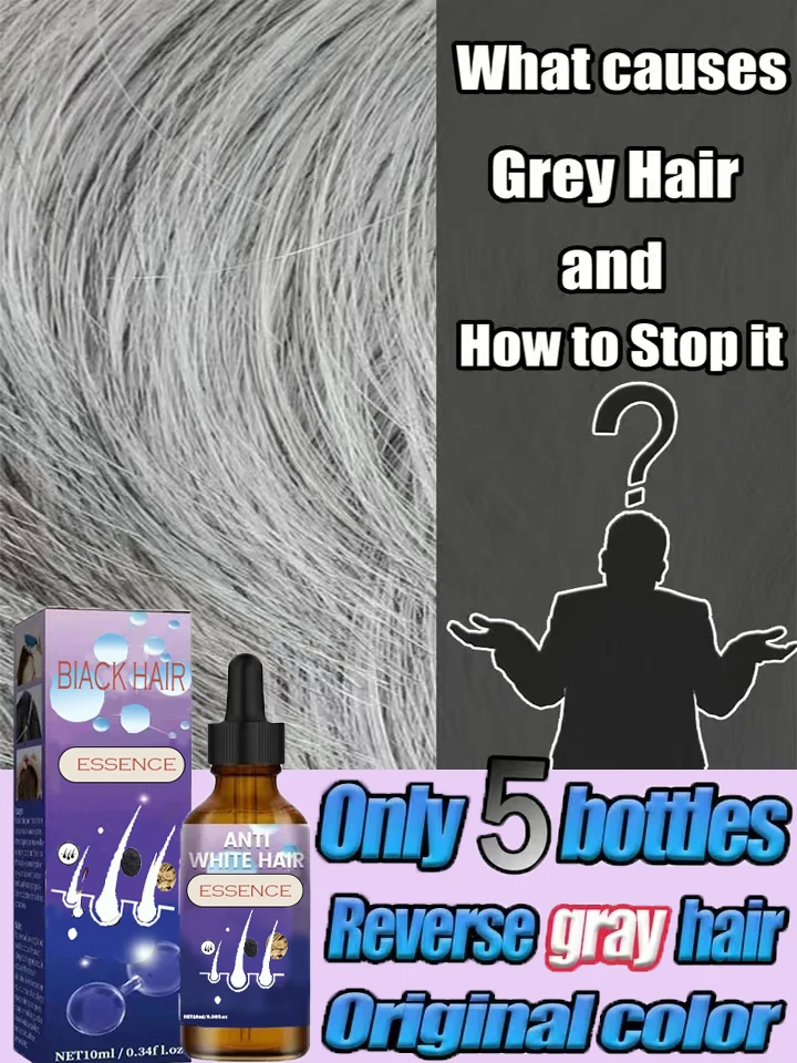 Pelo blanco, resolver el problema del pelo blanco y restaurar el color natural del cabello de la ra&iacute;z cabello
