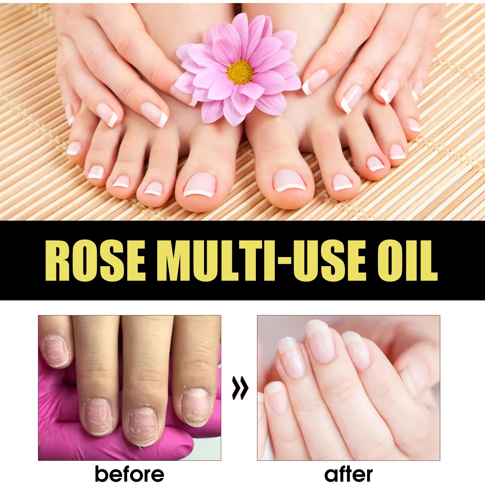 30ml Eelhoe Rose Petals Essential Oil Moisturizing Body Skin Hair Care Foot Anti-Chapping Multi-Effect Care Essential Oil