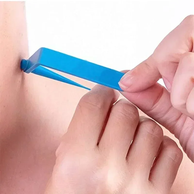 Skin Tag Removal Kit Treatment Tools Set Cleansing Swabs skin tag removal tool skin tag removal pen