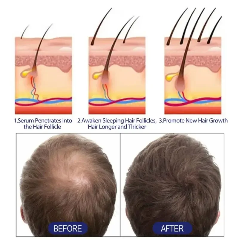 Hair Fibers Keratin Topic Thickening Spray Hair Building Fibers 27.5g Loss Products Instant Regrowth Powders Growth Product hair building powder hair building fibers hair growth spray