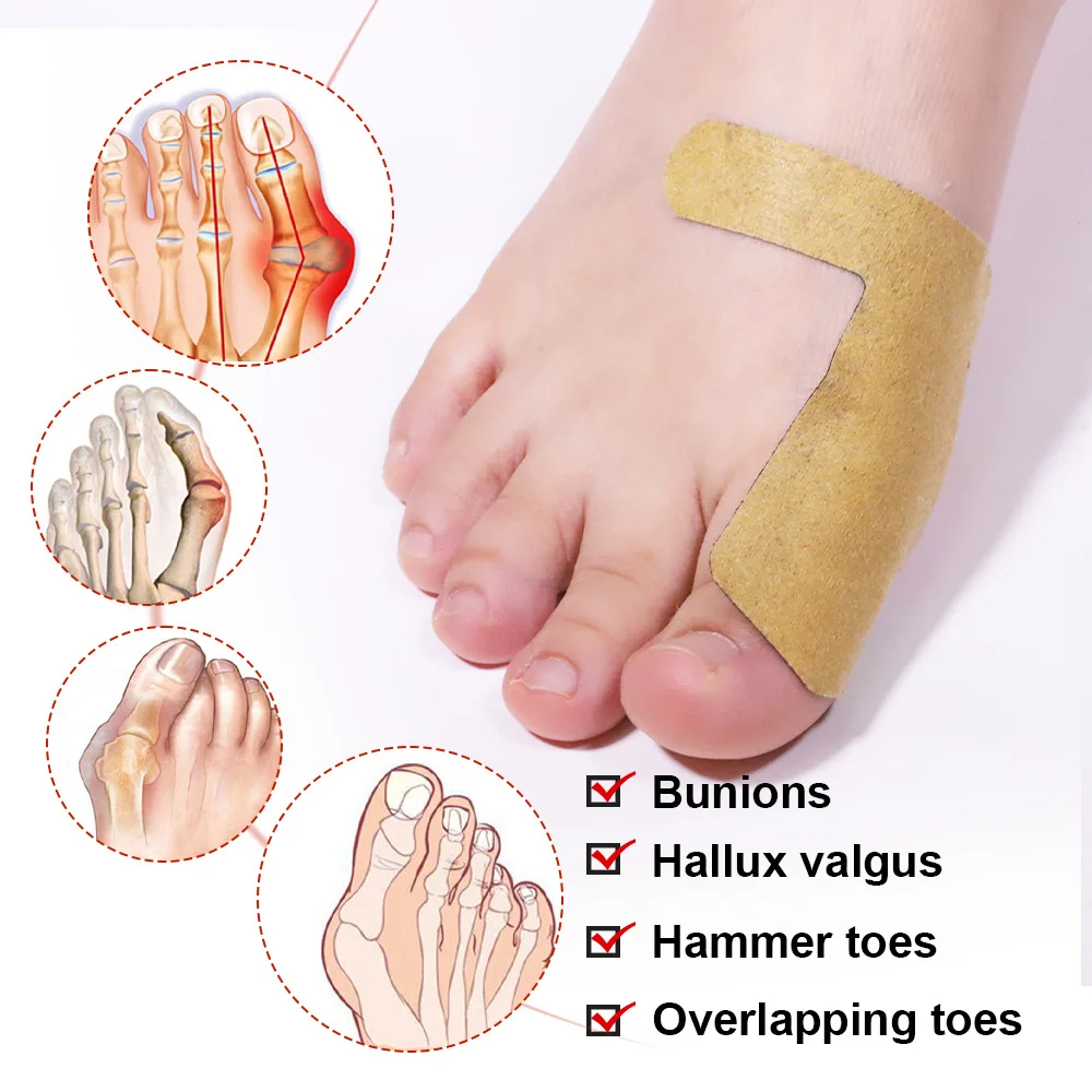 Gout Plaster Toe Bunion Hallux Valgus Pain Relief Care Stickers Finger Thumb Joint Sprain Ache Massage Plaster pain analgesic cream