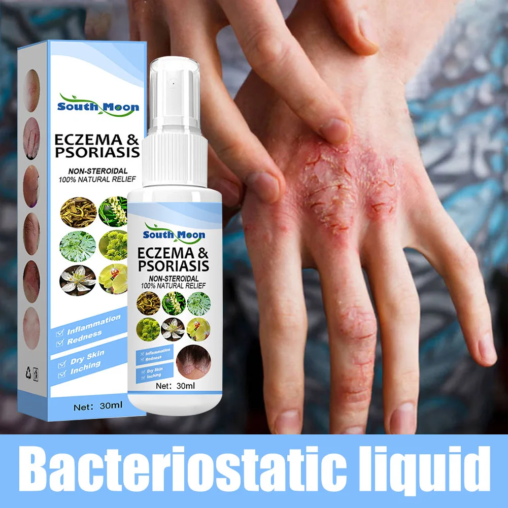 30ml Skin Psoriasis Spray Natural Herb Eczema Treatment Spray Itch Relief Improve Redness Dermatitis Psoriasis Health Care