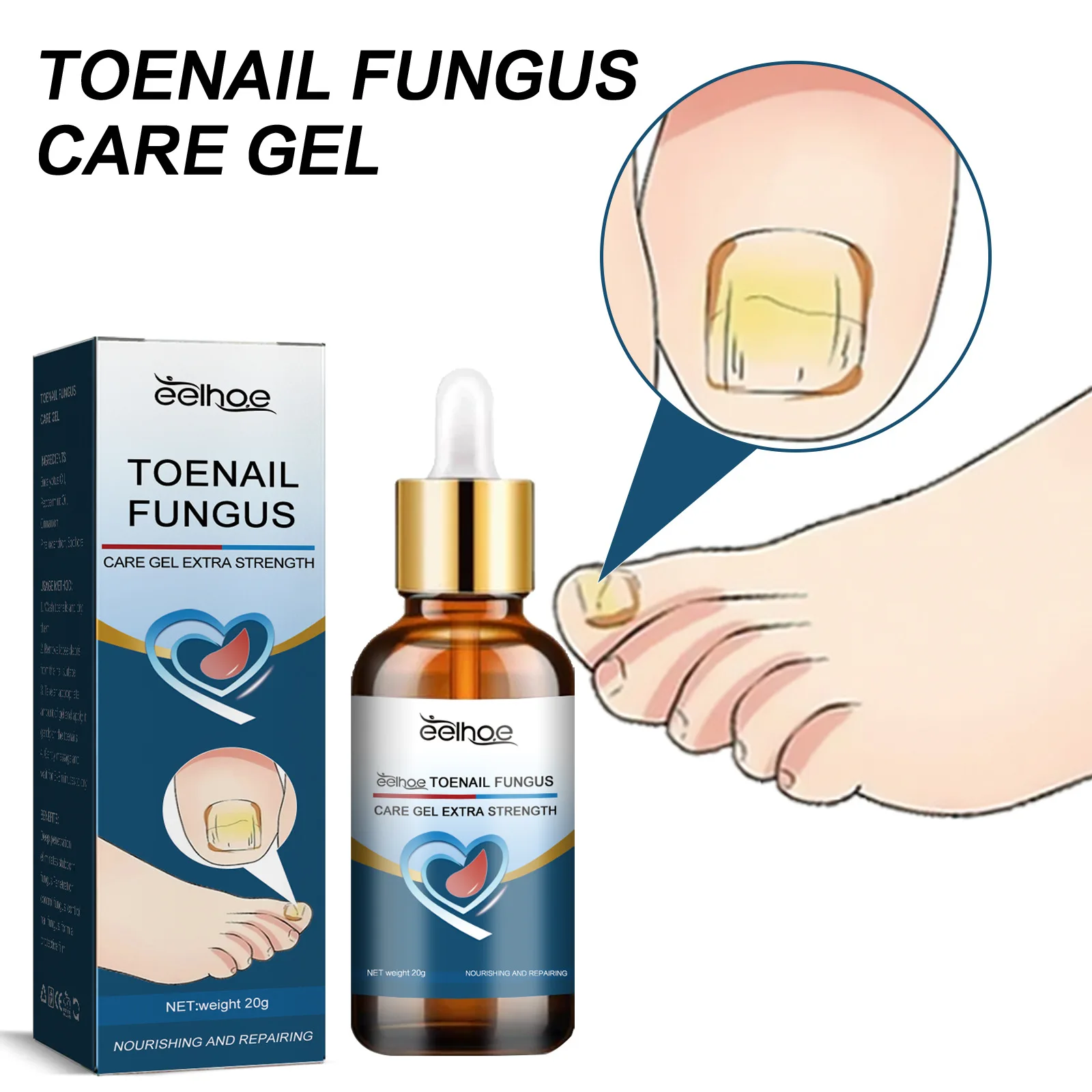 

Anti Paronychia Serum Onychomycosis Anti Infection Reduce Ingrown Disinfects Restore Shine Toenail Fungus Removal Essential Oil