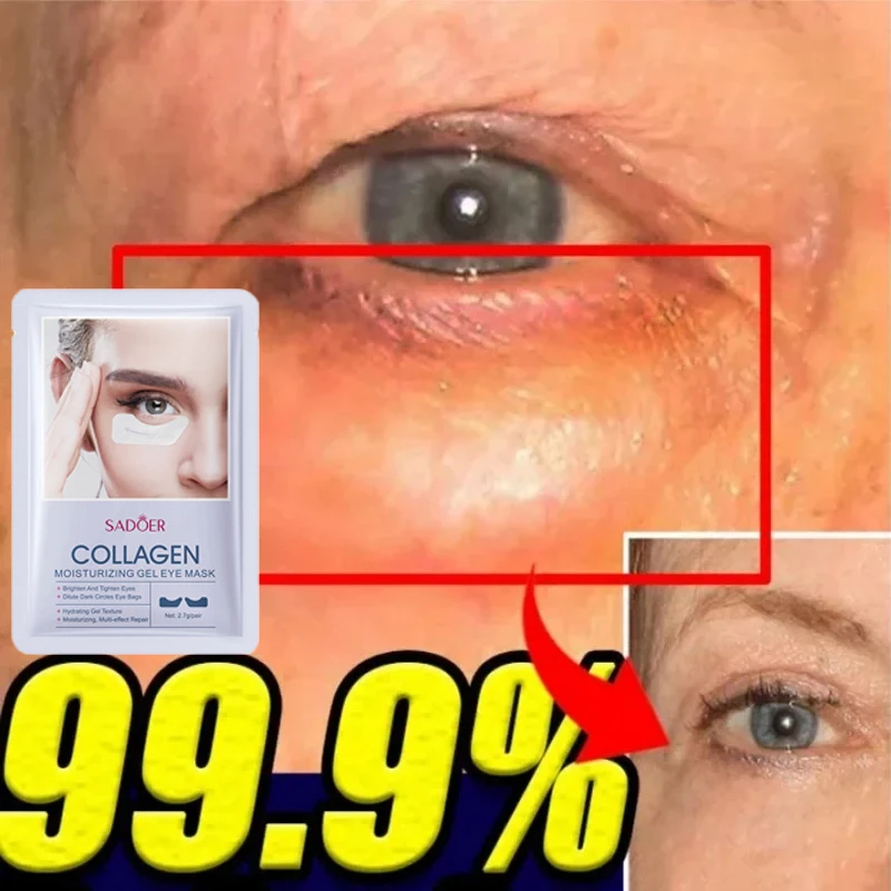 Eyes Bag Remove Collagen Eye Patch Instant Fade Fine Lines Dark Circles Fat Particles Moisturizing Anti-Puffiness Korea Eye Care