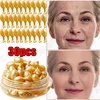 Freckle Whitening Serum Black Dots Melasma Remover Anti Brown Stain Lighten Pigmentation Moisturizing Skin Care Korean Products 3